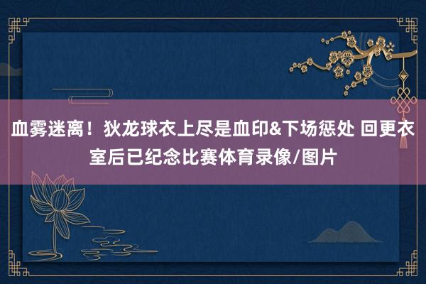 血雾迷离！狄龙球衣上尽是血印&下场惩处 回更衣室后已纪念比赛体育录像/图片